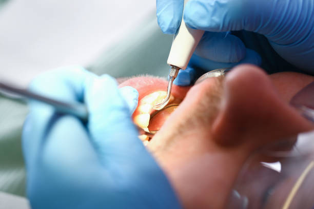 Best Urgent Care for Lost Fillings or Crowns in Roxana, IL