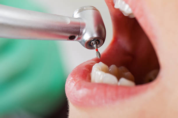 Best Emergency Denture Repair in Roxana, IL